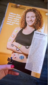 Artikelseite in Focus Diabetes mit Sonja Spörlein und Stickern auf der Haut